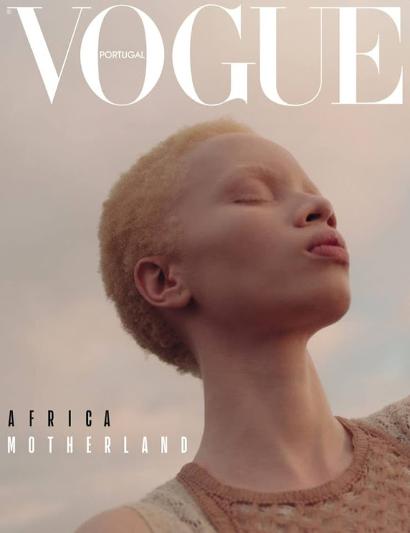 Thando Hopa, a South African model, lawyer, and activist. became the first woman with Albinism to be on the cover of Vogue in 2019.